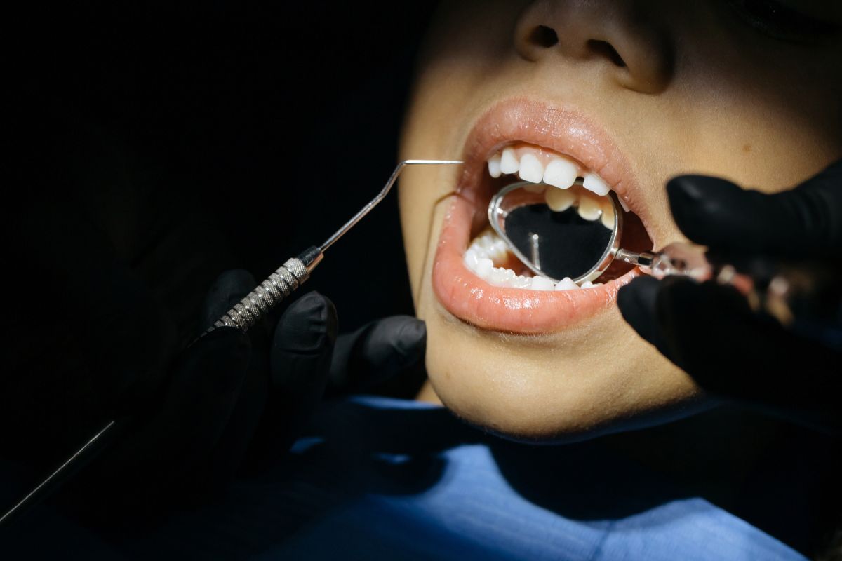 Dental Crowns Teeth Checkup- Taylorsville Implant Center
