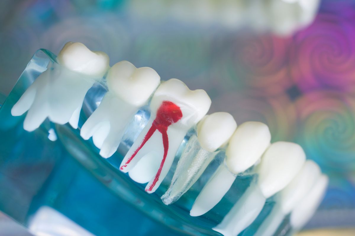 Damaged teeth repair- Taylorsville Implant Center