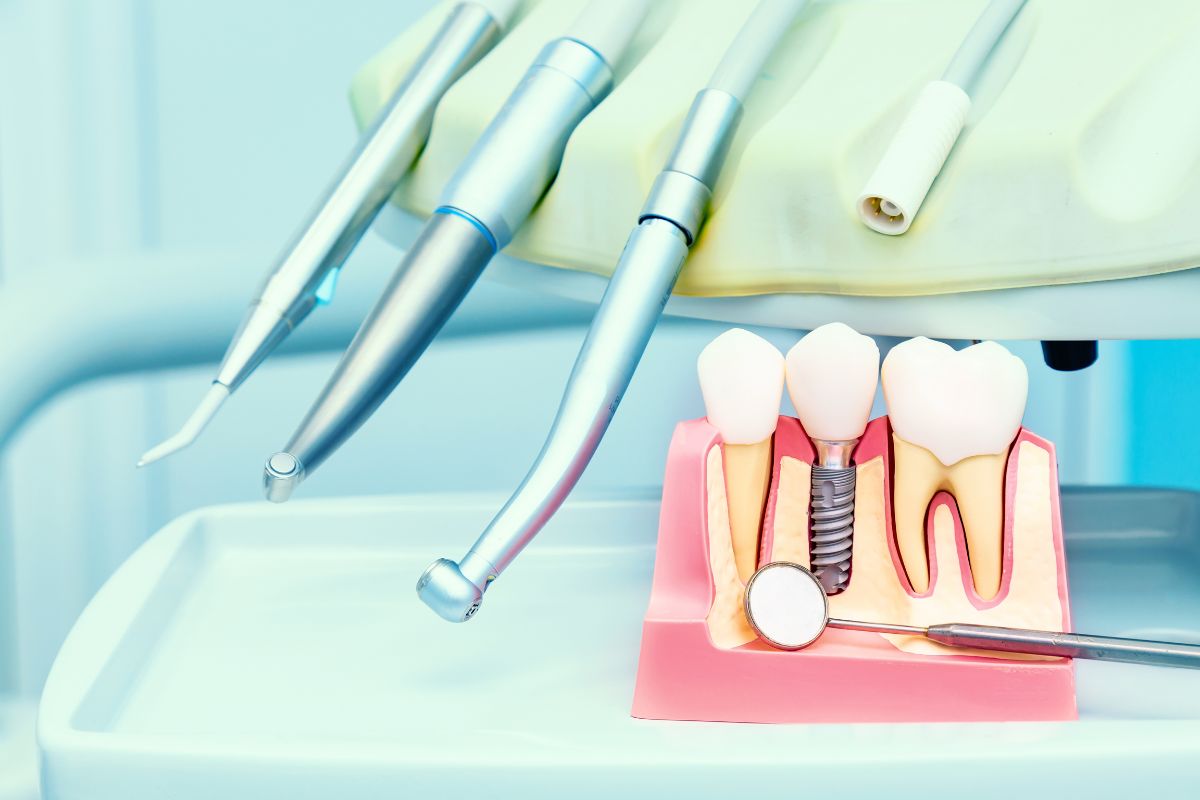 Dental Implant Process- Taylorsville Implant Center