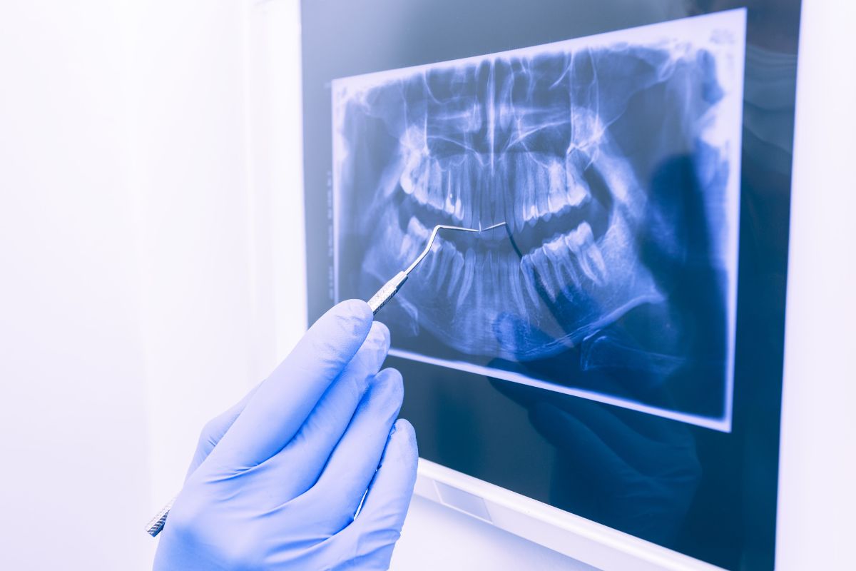 General Dentistry Teeth X-Ray- Taylorsville Implant Center | Dr. Jose Hernandez Gil